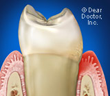 Pittsburgh Periodontist Treats Gum Disease