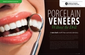 Porcelain Veneers — Without A Drill