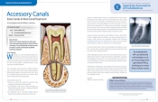 Accessory Canals