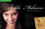 The Impact of a Smile Makeover — What does it really mean?