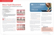 Minor Tooth Movement