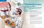 Periodontal Surgery — Where Art Meets Science