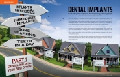 Dental Implants — Evaluating Your Options for Replacing Missing Teeth