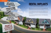 Dental Implants — Evaluating Your Professional Options for Care