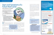 Signs and Symptoms of a Future Root Canal