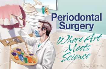 Periodontal Surgery.