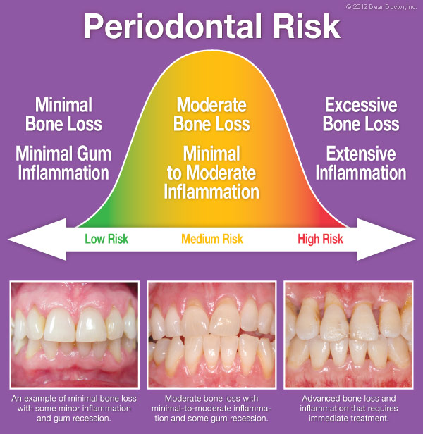 Successful Dental Treatment Identifying Risks To Successful Dental Treatment