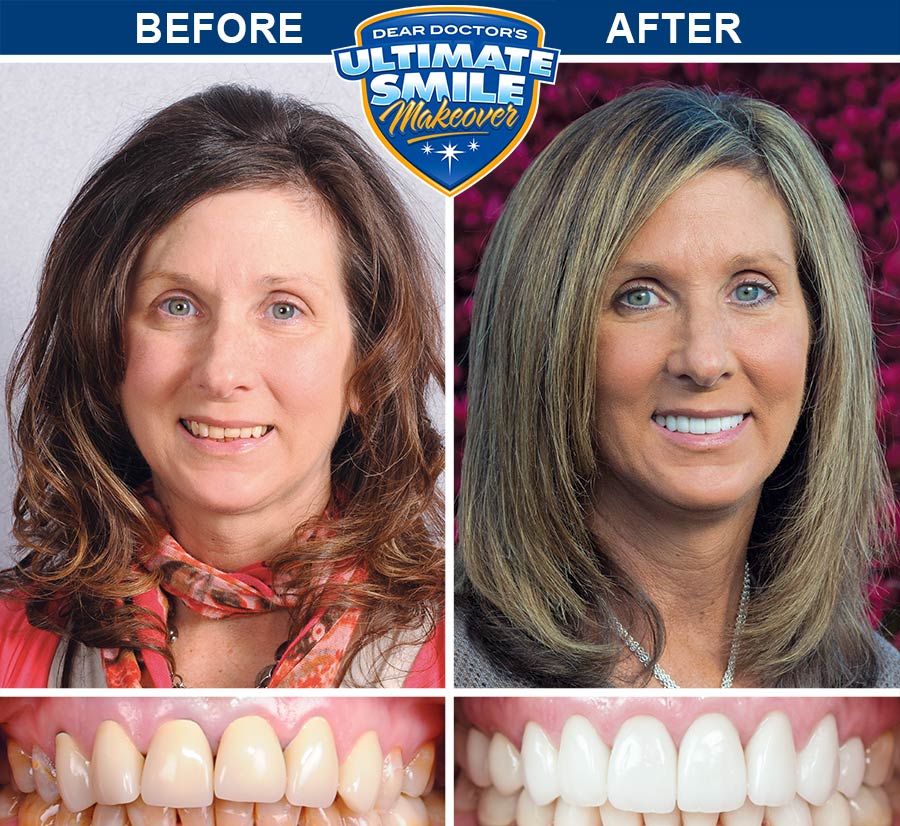 Smile Gallery Before And After Dental Photos Smile Makeovers Images